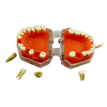 Модель реставрации зубов 1: 1, модель десен, демонстрация зубов пациентом стоматологической клиники, Инструменты стоматолога из силиконового материала